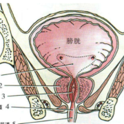 胎儿巨膀胱生下来要多少钱,胎儿膀胱偏大是什么原因造成的