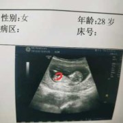 12周胎儿大小的标准是多少,nt12周能看出胎儿性别吗
