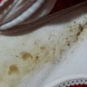 孕21周多，内裤皮筋勒，对孩子有影响吗,内裤太紧会压迫胎儿吗图片