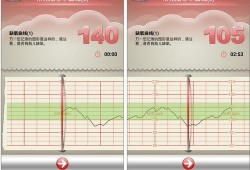 孕期心跳快是什么原因（心率快是怎么回事）