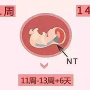 nt增厚胎儿正常的概率（nt增厚羊穿容易过吗）