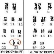 胎儿染色体y（y染色体是怎么组成）