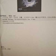 备孕期间可以做彩超吗（备孕期间可以做彩超吗女）