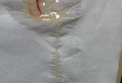 怀孕期间白带多是男孩（怀孕期间白带多是男孩）