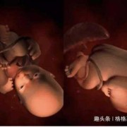 38周的胎儿是什么样子,38周胎儿图片