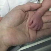 31周生下来的胎儿图（怀孕31周4天胎儿多大，有几斤重呢）