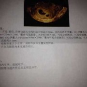 双胞胎孕期（双胎一大一小正常吗）
