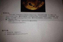 双胞胎孕期（双胎一大一小正常吗）