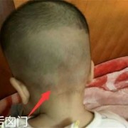 胎儿脑门宽（胎儿脑门宽 生下来会变小吗）