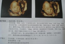 胎儿常规彩超检查什么（宝宝四维彩超是什么）