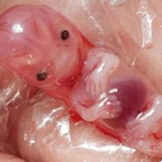 流产的胎儿怎么处理（流产的胎儿怎么处理）
