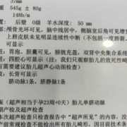 单脐动脉对胎儿有什么影响（胎儿单脐动脉会有什么影响）