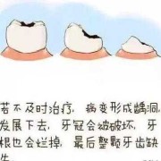 孕期牙齿松动（孕晚期一颗牙齿松动快要掉了有没有什么补救的方法）