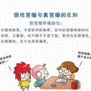 宫缩对胎儿有影响吗,总是宫缩对胎儿影响大吗
