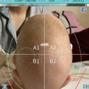 四个月宝宝舟状头还能矫正吗,胎儿颅骨呈舟状正常吗图片