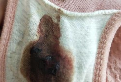 孕期流产症状（怀孕初期流产有什么症状）