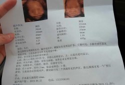 胎儿大排畸（大排畸多少周可以做）