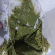 怀孕后大便绿色怎么回事,孕期大便绿色是什么原因