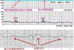 胎儿胎心率（胎儿胎心率正常值）