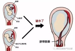 胎儿没膀胱（胎儿没膀胱会有羊水吗）