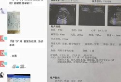 b超体重跟胎儿实际体重相差多少,b超单怎么算胎儿身高多少