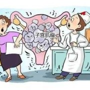 孕期子宫肌瘤注意（怀孕有子宫肌瘤有影响吗）