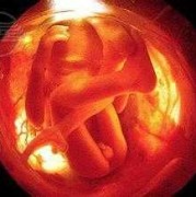 37周宝宝在肚里是什么样,37周的胎儿图片是什么样子的?