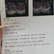 孕早期b超ut是什么？能看出什么呢,孕早期做b超对胎儿有影响吗 好大夫