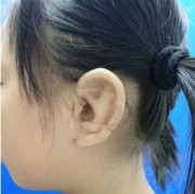 宝宝耳朵怎么会畸形的啊？怀孕期间需要注意哪些呢,检查胎儿畸形的方法有哪些