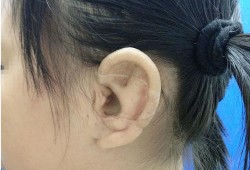 宝宝耳朵怎么会畸形的啊？怀孕期间需要注意哪些呢,检查胎儿畸形的方法有哪些