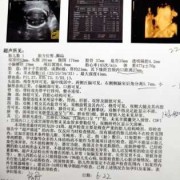 怀孕几个月会有心跳要怎么检测得到的,胎儿几个月有心跳声音