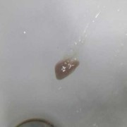 孕期咳嗽有黄痰（孕37周喉咙痛有黄痰，会感染胎儿吗）