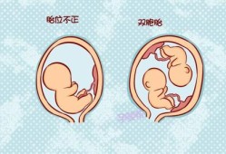孕21周胎儿在什么位置（孕21周胎儿在什么位置）