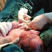 孕妇抠肚脐眼对胎儿有影响吗（孕妇抠肚脐眼对胎儿有影响吗视频）