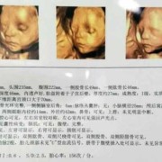 整个孕期要做几次四维彩超？一般只做1次就可以吗,怀孕期间做几次检查最好
