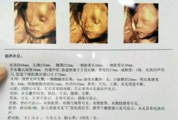 整个孕期要做几次四维彩超？一般只做1次就可以吗,怀孕期间做几次检查最好
