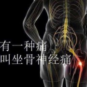 怀孕了坐骨神经疼的厉害怎么办才好呢,孕期坐骨疼怎么回事