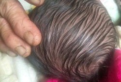 宝宝头顶有一块是软的怎么回事,胎儿软指标异常严重吗