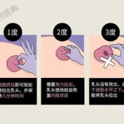 孕期乳房有硬块（乳房有肿块，鸡蛋大小，硬硬的，该怎么办呢，希望得到尽快解决）