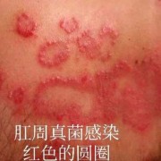 胎儿肛门（两岁的宝宝大便是有红色的肉在屁眼哪里）