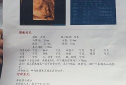 怀孕19周做2维彩超说胎儿胃泡显示不清。怎么办,胎儿胃泡是什么回声