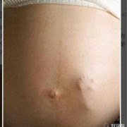 孕36周，胎宝宝在肚子里使劲顶肚皮，还挺频繁，正常么,腹部用力对胎儿的影响有哪些