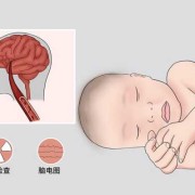 婴儿大脑缺氧的症状,孕妇胎儿缺氧有什么症状