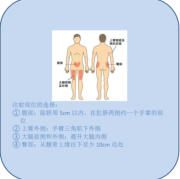 血糖高孕妇能打胰岛素吗,孕期胰岛素打哪里比较好
