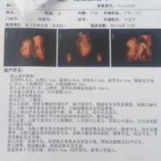 孕期可以做两次四维吗（孕期可以做两次四维吗）
