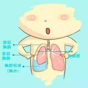胎儿胸腔积液怎么办,如何让胎儿吸收积液呢
