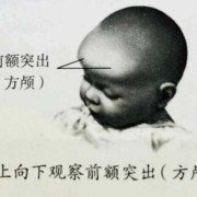胎儿颅骨呈椭圆形好吗（方颅顶如何判断）