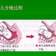 胎儿娩出过程下降衔接（胎儿出生下降,衔接）