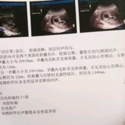 孕囊是胎儿吗（孕囊的读音）