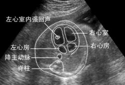 胎儿左心室强光点（胎儿左心室强光点是什么意思）